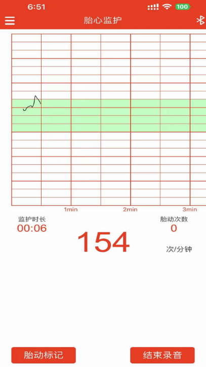 用手机直接测胎心软件分享 可以用手机测胎心的app盘点